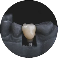 dental-implants