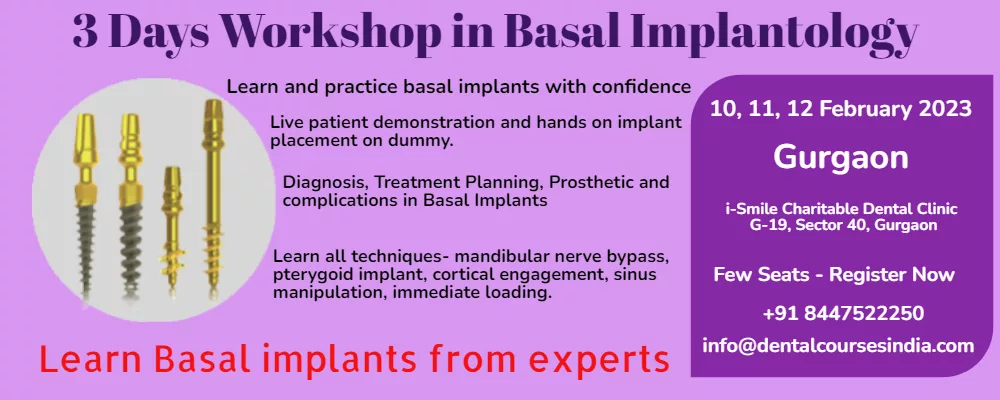 basal-implants-feb'23