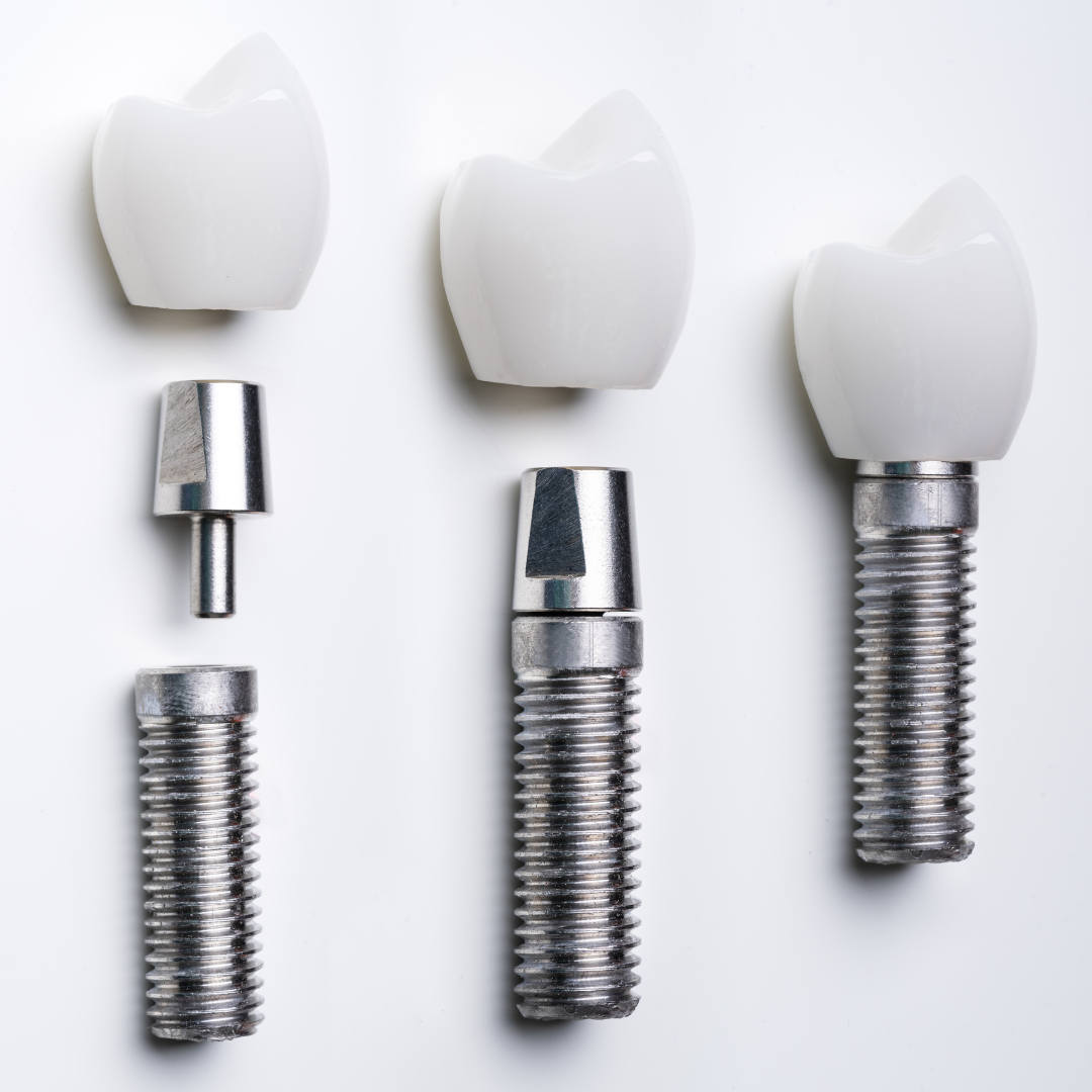 endo-osseous-implants-Gurgaon