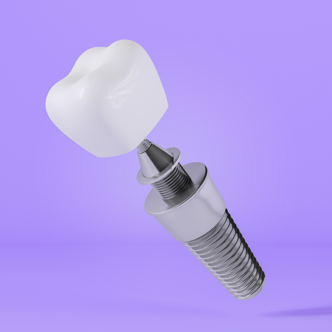 dental-implant-gurgaon