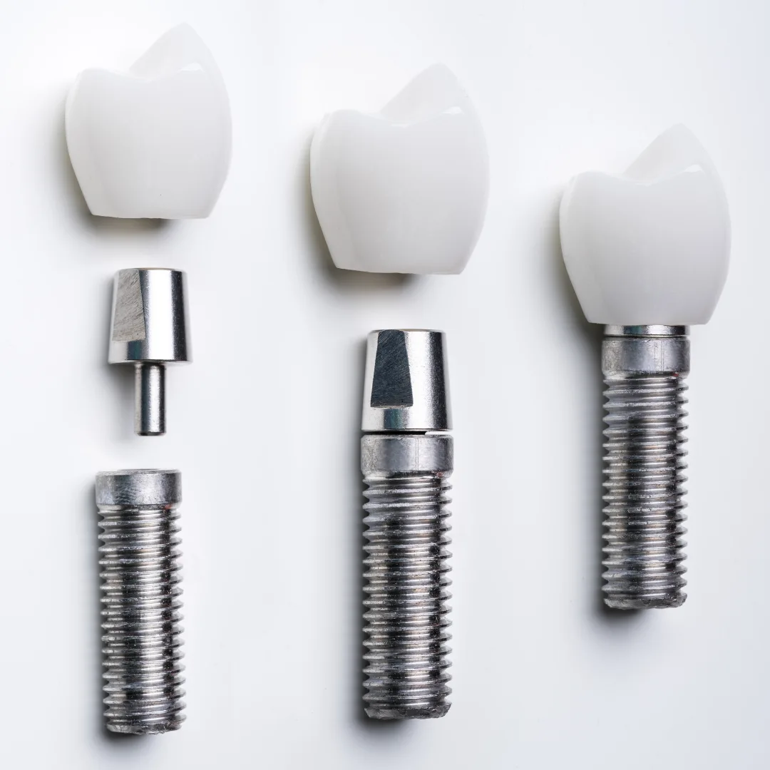 Traditional dental implant in Gurgaon