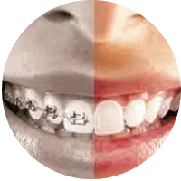 best-orthodontist-in-Gurgaon