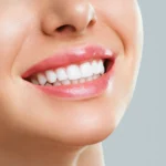 teeth-cleaning-in-Gurgaon