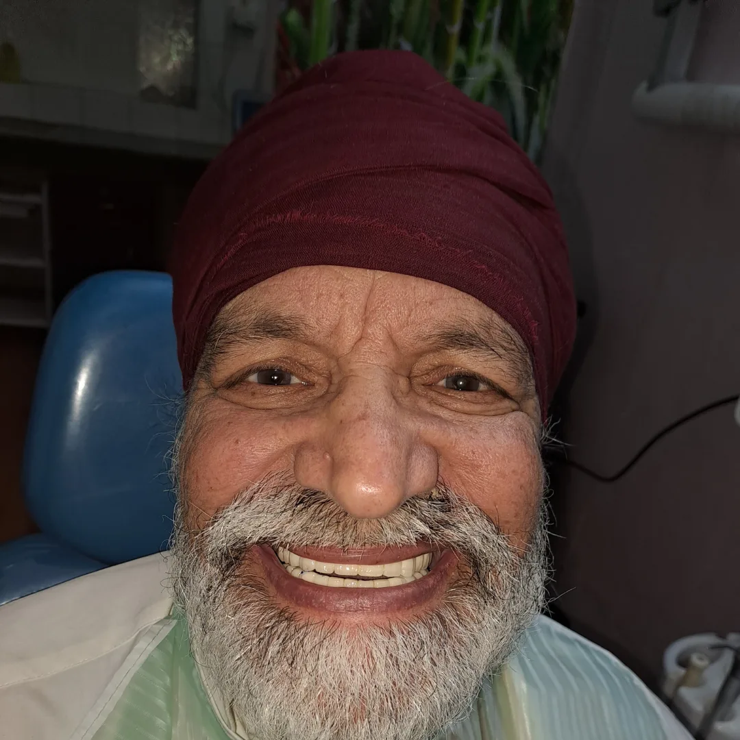 Patient Jasbir Singh from London got dental Implants at i-Smile