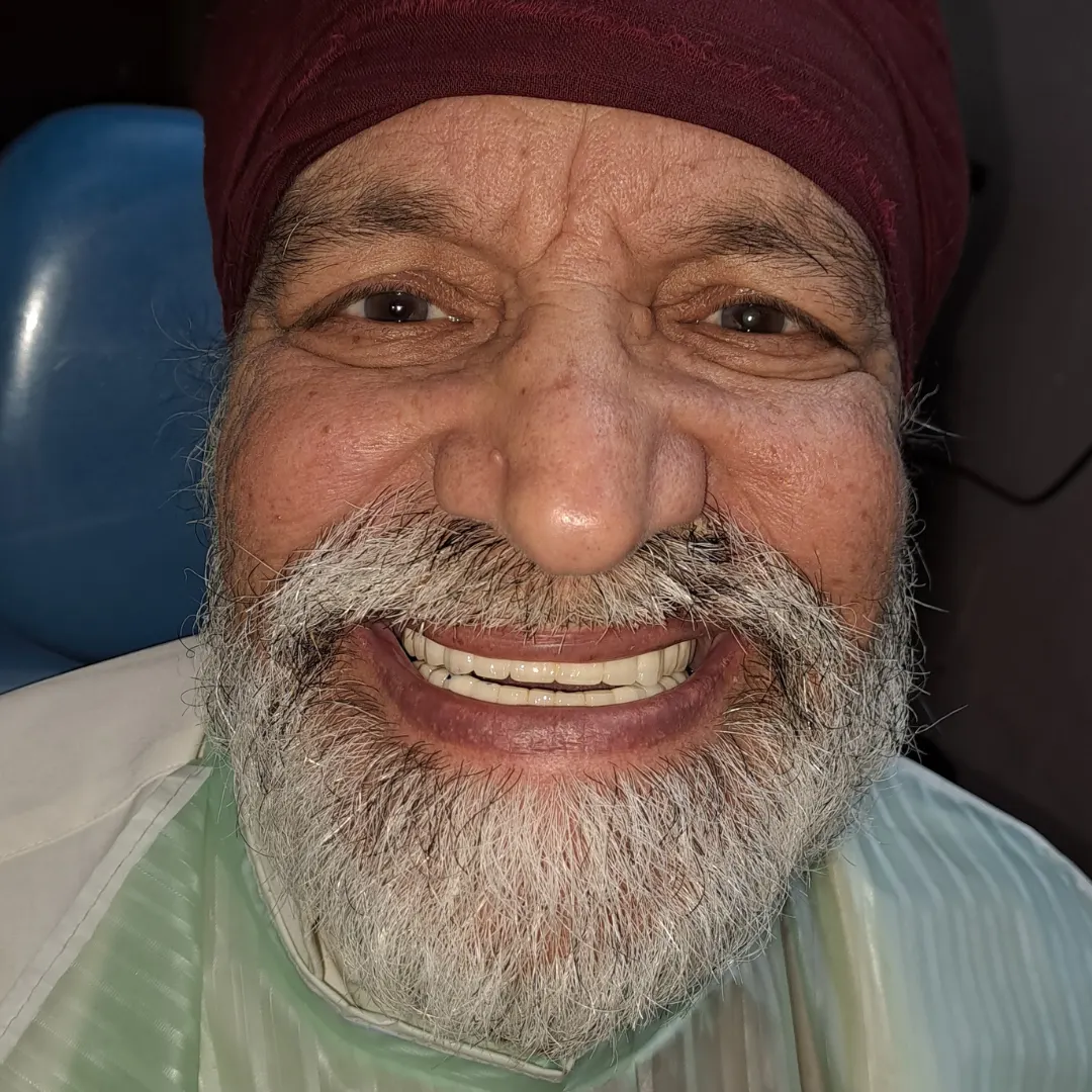 full mouth dental implant in Gurgaon at i-Smile Charitable Dental Clinic